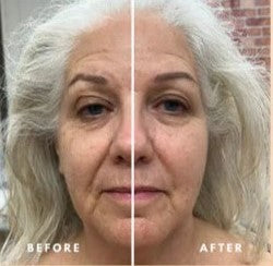 primefy™ Lymphatic Face Brush